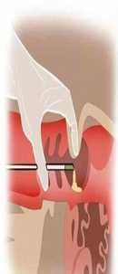 <strong>情绪管理在着床期对试管婴儿成功率的决定性作用</strong>