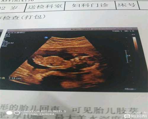 孕六月：给宝宝做个求知胎教