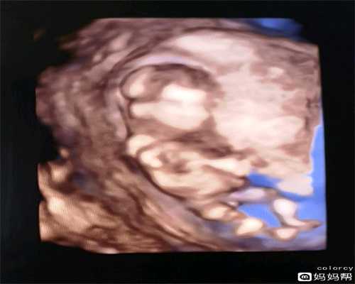 广州助孕中介：排卵期出血是怎么了会影响怀孕
