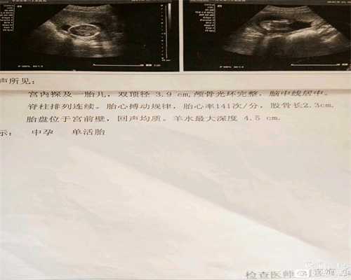广州助孕招聘：生男生女有暗示怀孕期间，你被