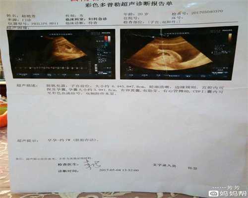 广州供卵助孕,孕期常做这“4件事”的准妈妈，宝