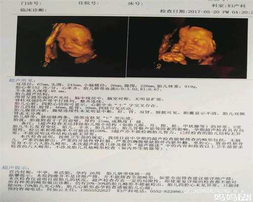广州代孕哪里正规,为什么要提前3个月备孕我们应