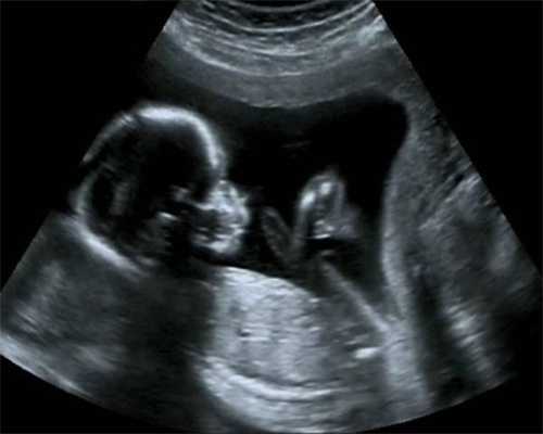 广州的精英宝贝可靠吗,专家警告绵阳一孕妇因孕