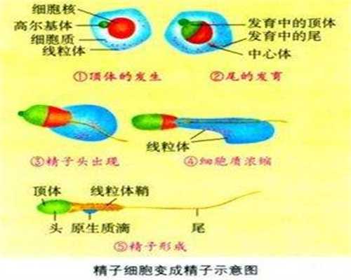 广州最靠谱的助孕机构,多囊卵巢综合征的女性，