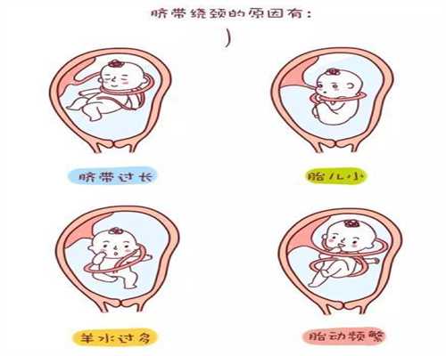 孕期NT检查，胎儿一直趴着不动怎么办做好这几点