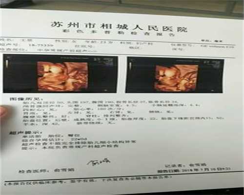 广州代孕网哪个正规,怀孕35周，婆婆让我去胎毒