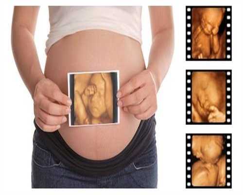 系统性回顾研究约五分之一新冠孕妇早产 常见共