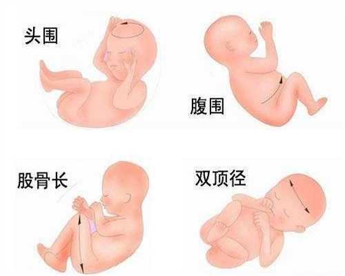 广州哪里做代妈报酬高,俄罗斯试管婴儿怎样算怀