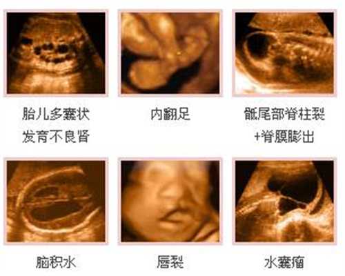 广州有哪些助孕中心,三位“假戏真做”的女演员