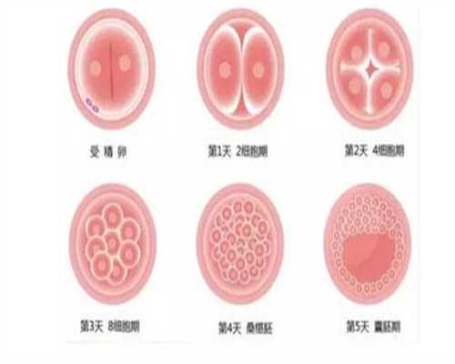 广州代孕生男孩-孕初期腹泻是宫外孕吗