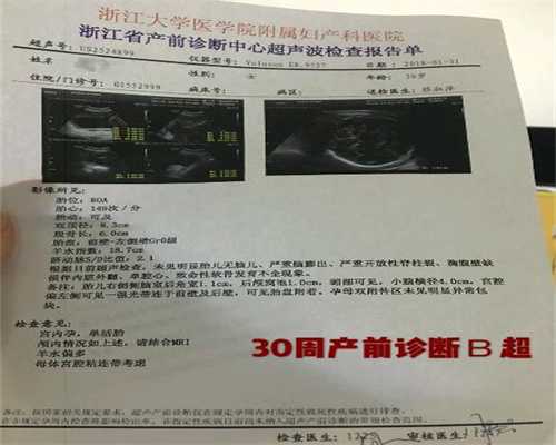 广州代孕公司哪里成功率最高-怀双胞胎顺产还是