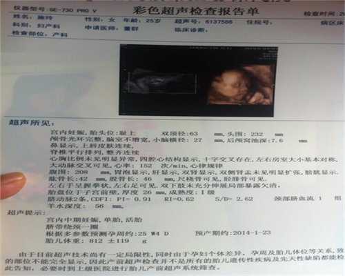 代孕产子广州-怀孕初期hcg低的表现