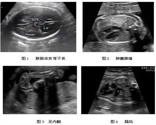 广州代孕爱问知识人-孕妇能不能吃艾叶鸡蛋
