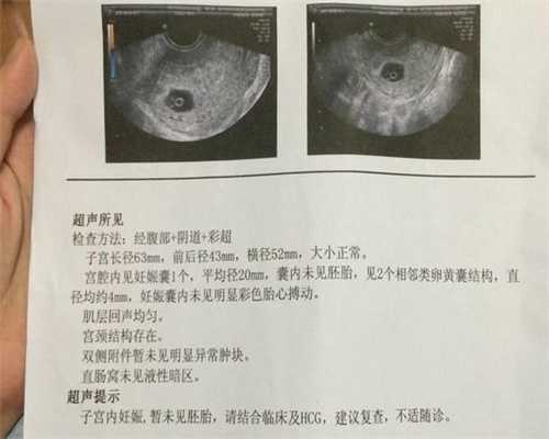 广州子博代孕网招怀孕21万起-怀孕能不能吃香梨