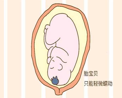 广州代生双胞胎机构-孕妇在工厂上班好吗