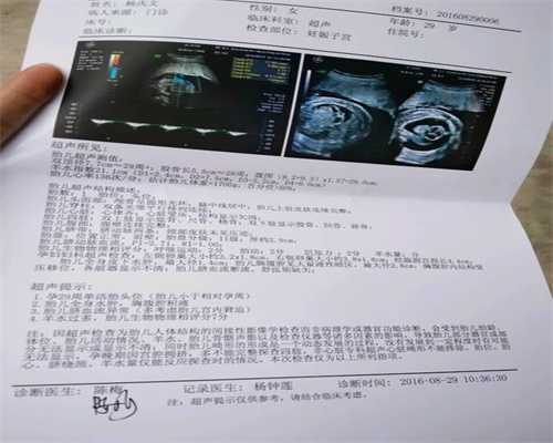 广州代孕最好三甲医院-怀孕多久用b超测出来
