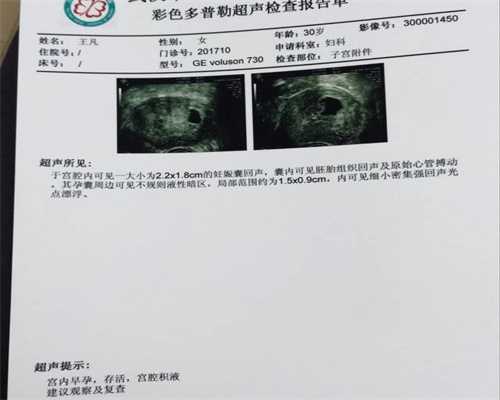 广州代孕成功的姐妹-妊娠期急性脂肪肝严重吗