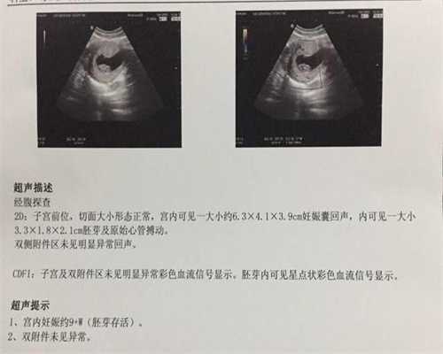 广州代生男孩公司-孕三个月肚皮痒正常吗