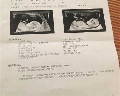广州代孕双胞胎多少钱-生二胎的坏处和影响有哪