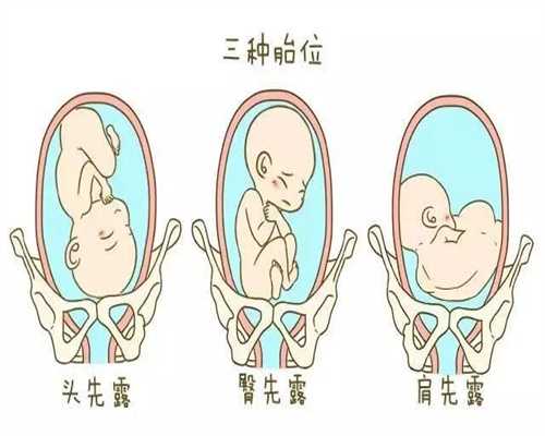 广州什么地方有代孕有多少佣金-怀孕会引起发烧