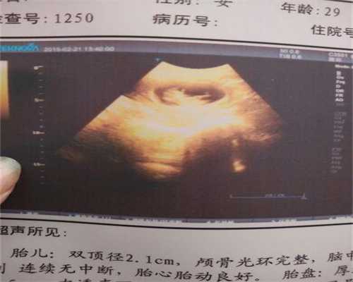 广州代孕医院吗-孕妇可以吃海参吗