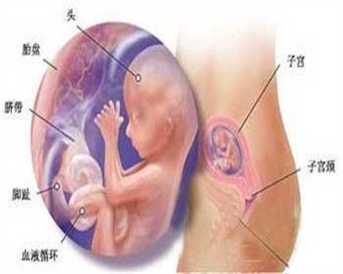 广州代生儿子正规吗-孕中期出现息肉出血的症状