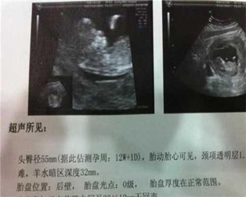 广州代孕双胞胎多少钱-怀孕腰特别酸怎么回事