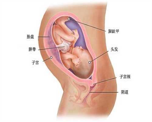 有谁去广州做试管婴儿：胎盘低置可以坐飞机吗
