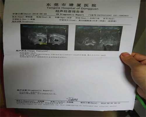 广州助孕费用：怀孕八个月出血原因是什么