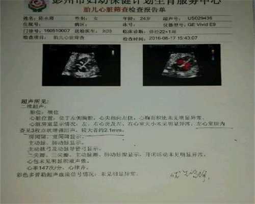 广州供卵试管中心排行：高龄产妇真的容易唐氏