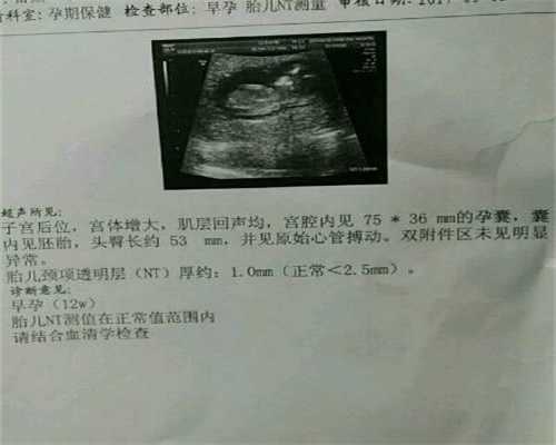 广州哪里可以第三代试管：胎心监护不过关的危