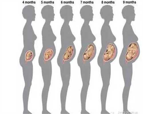 广州代孕在哪里_这6类孕妇，分娩时适合剖腹产，