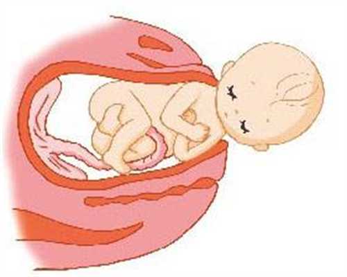 广州代孕在哪里_这6类孕妇，分娩时适合剖腹产，