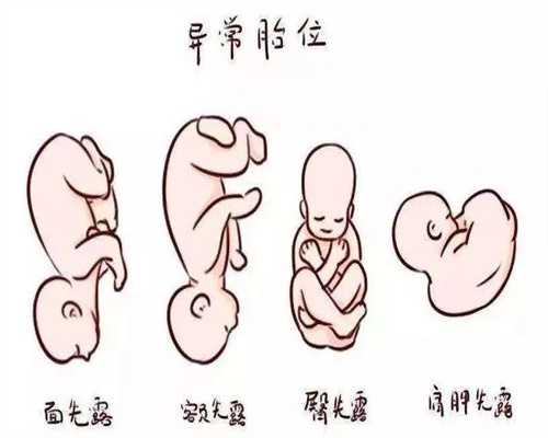 广州滨哪里有助孕_吃儿童益生菌看不到效果 有可