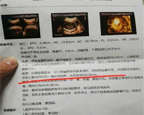 <b>广州代孕咨询_普通口罩可以防冠状病毒吗</b>