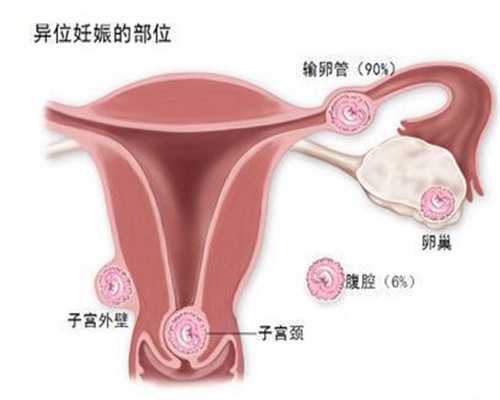 广州代孕孩子包成功_孕妇一定要数胎动吗