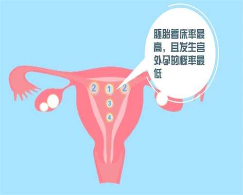 广州代孕产子价格是多少_孕妇假性宫缩怎么办