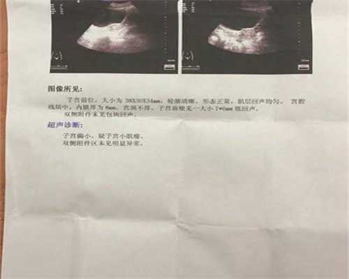 广州代孕产子公司多少钱_高龄孕妇容易流产吗
