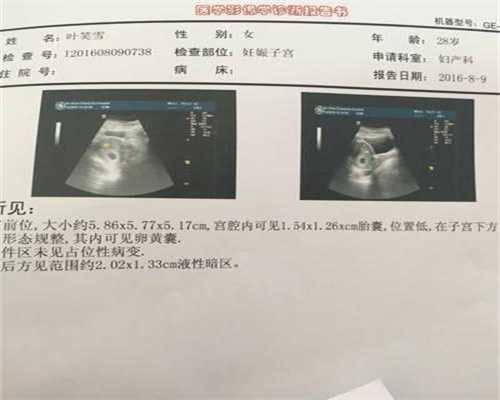 新亚广州代孕公司_怀孕72天能做无痛人流吗
