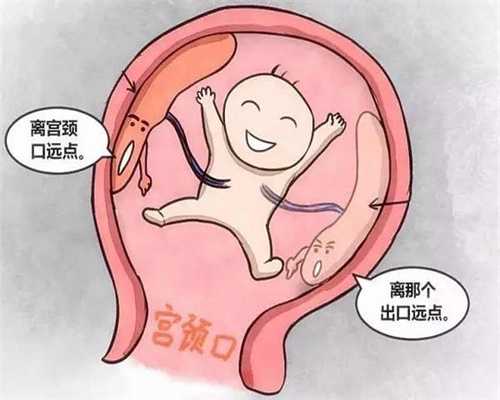 广州代孕价格~广州哪里要代孕~广州不孕不育医院排名