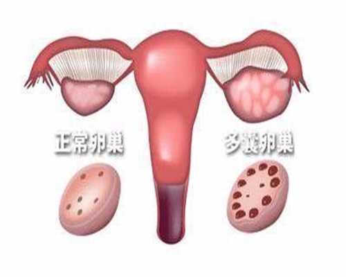 广州代生孩子，广州做代孕条件，广州代孕需要什么手续