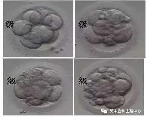 广州正规代孕，广州代孕生儿子中介，广州做第三代试管代孕的流程
