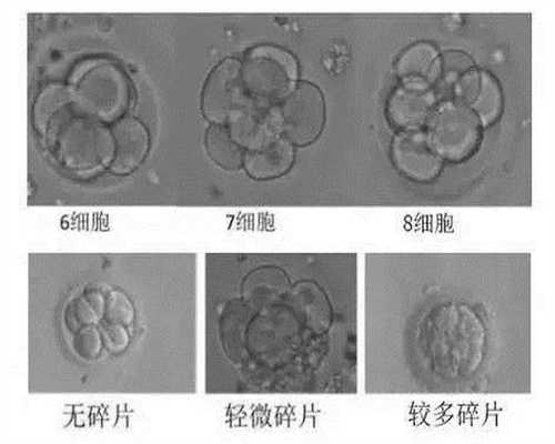 广州代孕中心~广州供卵代孕包生子~广州借卵代孕也并不是哪么难