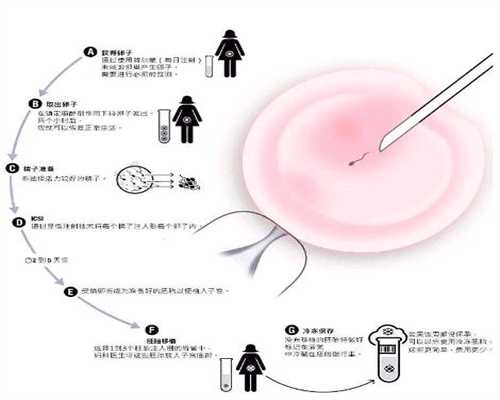 广州代孕服务-广州代孕做男孩价格-有在广州代孕成功的吗