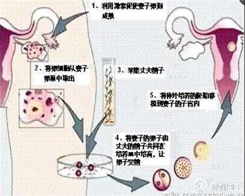 广州代孕电话_代孕可以在医院做吗_2020年代孕价