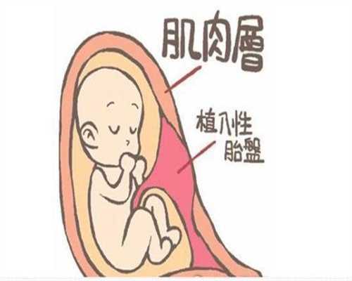 广州代孕网_代怀小孩哪家优惠_正规代孕
