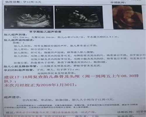 广州代孕不孕咨询_什么是生殖助孕_最大助孕公司