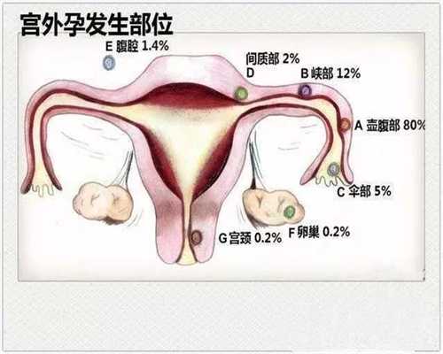 广州代孕正规吗_代孕孩子哪家成功率高_代孕孩子可靠吗
